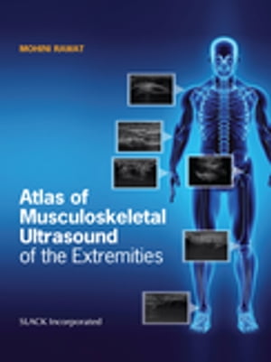 Atlas of Musculoskeletal Ultrasound of the Extremities