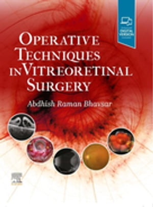 Operative Techniques in Vitreoretinal Surgery