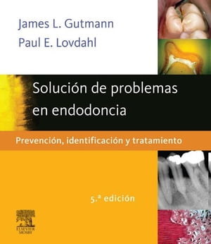 Solución de problemas en endodoncia