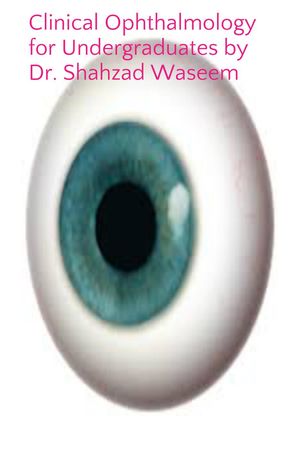 Clinical Ophthalmology for Undergraduates by Shahzad Waseem