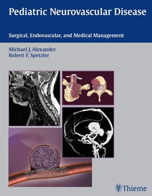 Pediatric Neurovascular Disease