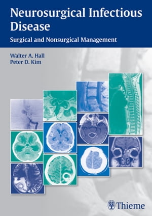 Neurosurgical Infectious Disease Surgical and Nonsurgical ManagementŻҽҡ