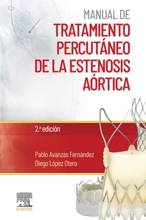 Manual de tratamiento percutáneo de la estenosis aórtica