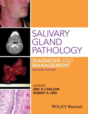 Salivary Gland Pathology Diagnosis and Management【電子書籍】 Robert A. Ord