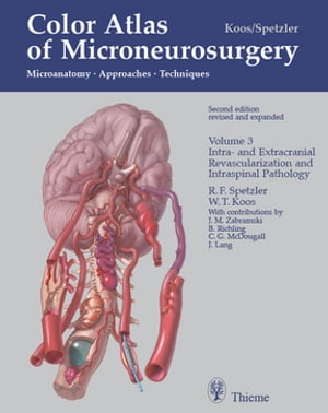 Color Atlas of Microneurosurgery: Volume 3 - Intra- and Extracranial Revascularization and Intraspinal Pathology