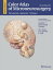 Color Atlas of Microneurosurgery: Volume 1 - Intracranial Tumors