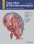 Color Atlas of Microneurosurgery: Volume 2 - Cerebrovascular Lesions