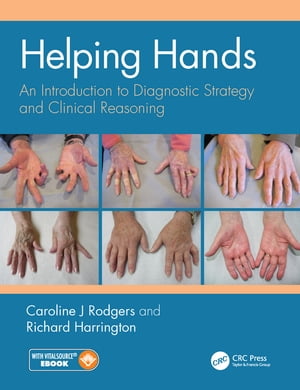 Helping Hands An Introduction to Diagnostic Strategy and Clinical Reasoning【電子書籍】 Richard Harrington