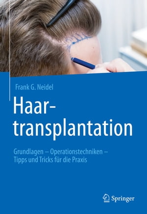 Haartransplantation