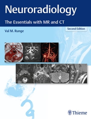 Neuroradiology