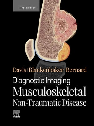 ŷKoboŻҽҥȥ㤨Diagnostic Imaging: Musculoskeletal Non-Traumatic Disease - E-Book Diagnostic Imaging: Musculoskeletal Non-Traumatic Disease - E-BookŻҽҡ[ Kirkland W. Davis, MD, FACR ]פβǤʤ32,574ߤˤʤޤ