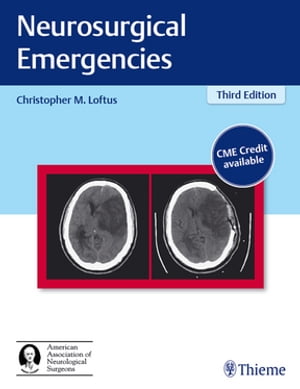 Neurosurgical Emergencies