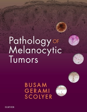 Pathology of Melanocytic Tumors E-Book