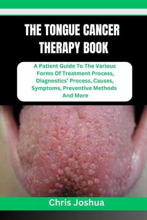 ŷKoboŻҽҥȥ㤨THE TONGUE CANCER THERAPY BOOK A Patient Guide To The Various Forms Of Treatment Process, Diagnostics Process, Causes, Symptoms, Preventive Methods And MoreŻҽҡ[ Chris Joshua ]פβǤʤ487ߤˤʤޤ