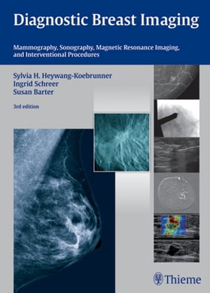 Diagnostic Breast Imaging Mammography, Sonography, Magnetic Resonance Imaging, and Interventional Procedures