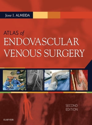 Atlas of Endovascular Venous Surgery