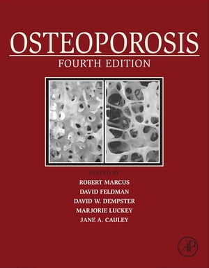 Osteoporosis