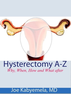 Hysterectomy A-Z: Why, When, How and What after