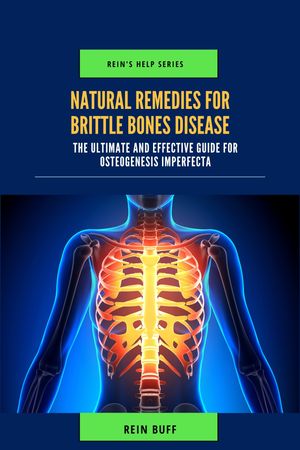 Natural Remedies for Brittle Bones Disease