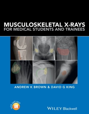 Musculoskeletal X-Rays for Medical Students and TraineesŻҽҡ[ David G. King ]