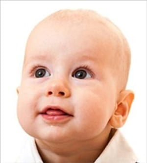 Craniosynostosis: Causes, Symptoms and Treatments