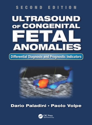 Ultrasound of Congenital Fetal Anomalies