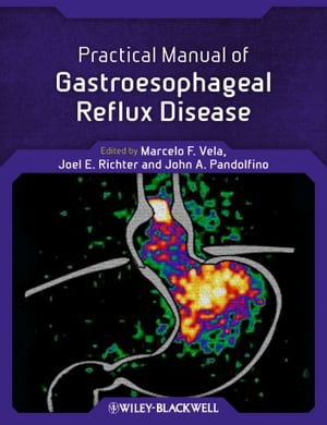 Practical Manual of Gastroesophageal Reflux Disease