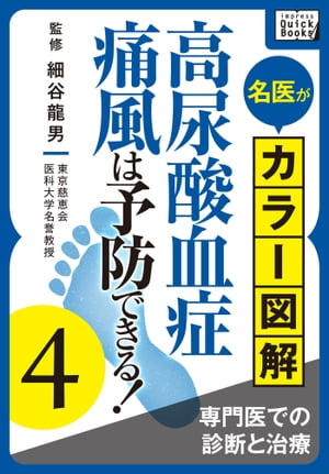 名医がカラー図解! 高尿酸血症・痛風は予防できる! (4) 専門医での診断と治療