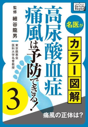 名医がカラー図解! 高尿酸血症・痛風は予防できる! (3) 痛風の正体は？