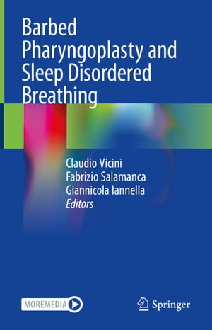 Barbed Pharyngoplasty and Sleep Disordered Breathing