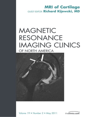 Cartilage Imaging, An Issue of Magnetic Resonance Imaging Clinics