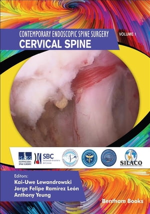 Contemporary Endoscopic Spine Surgery Volume 1: Cervical Spine