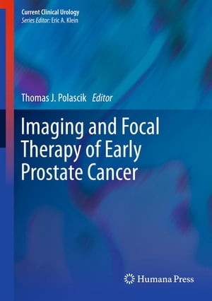 Imaging and Focal Therapy of Early Prostate Cancer