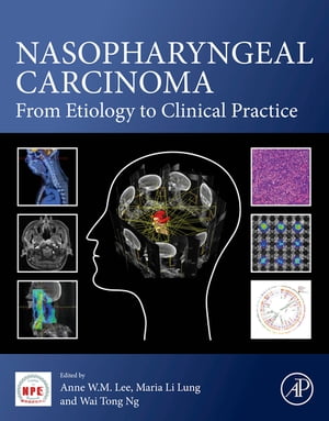 Nasopharyngeal Carcinoma From Etiology to Clinical Practice