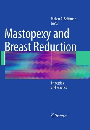 Mastopexy and Breast Reduction