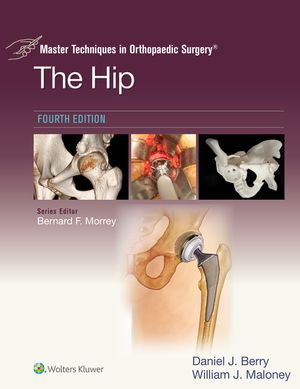 Master Techniques in Orthopaedic Surgery: The Hip eBook without Multimedia【電子書籍】[ Daniel J. Berry ]