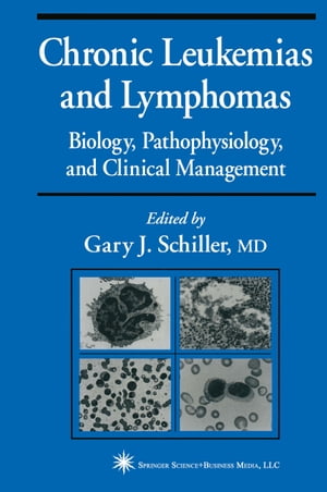 Chronic Leukemias and Lymphomas