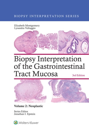 Biopsy Interpretation of the Gastrointestinal Tract Mucosa: Volume 2: Neoplastic