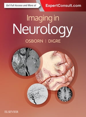 Imaging in Neurology