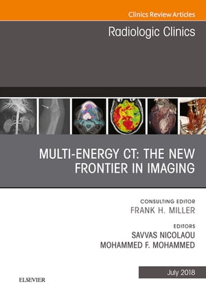 Multi-Energy CT: The New Frontier in Imaging, An Issue of Radiologic Clinics of North America