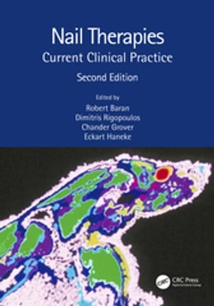 Nail Therapies Current Clinical Practice【電子書籍】