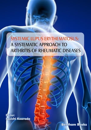 Systemic Lupus Erythematosus: A Systematic Approach to Arthritis of Rheumatic Diseases: Volume 4
