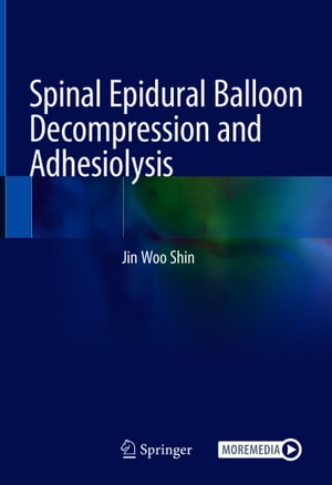 Spinal Epidural Balloon Decompression and Adhesiolysis