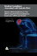 Medical Conditions Associated with Suicide Risk: Human Immunodeficiency Virus (HIV) / Acquired Immunodeficiency Syndrome (AIDS) and Suicide