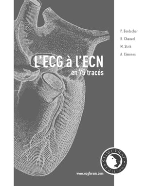 L'ECG à L'ECN en 75 tracés