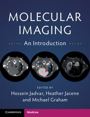 ＜p＞Engage with the visual world of disease with this accessible introduction to molecular imaging. This book provides users of all levels with the characterization and measurement of biological processes on a cellular level, functioning within humans, and other living systems. This important new introduction to the field will enable the reader to recognize the major methods, modalities and varied applications of molecular imaging in an efficient and effective way. Featuring techniques from areas such as nuclear medicine, magnetic resonance spectroscopy, optical imaging, and nanotechnology, the book also covers the current movement towards precision medicine thereby driving exceptional hospital care, worldwide. Molecular Imaging provides valuable insight into the properties that improve patient diagnosis. Serving to inform experienced physicians, students, and beginners alike, this convenient introduction is tailored to an individual with the desire to effectively grasp the basic concepts of molecular imaging, under the constraints of a busy professional career.＜/p＞画面が切り替わりますので、しばらくお待ち下さい。 ※ご購入は、楽天kobo商品ページからお願いします。※切り替わらない場合は、こちら をクリックして下さい。 ※このページからは注文できません。