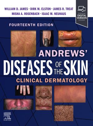 ŷKoboŻҽҥȥ㤨Andrews' Diseases of the Skin E-Book Clinical DermatologyŻҽҡ[ William D. James ]פβǤʤ27,635ߤˤʤޤ