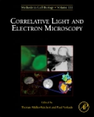 Correlative Light and Electron MIcroscopy