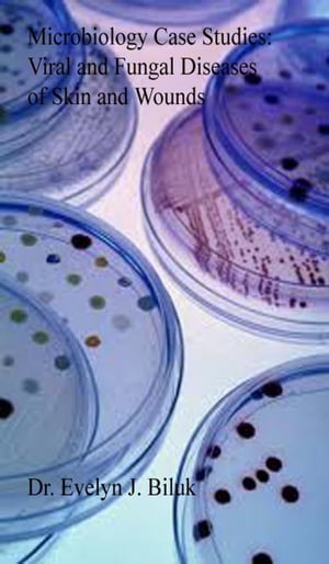 ŷKoboŻҽҥȥ㤨Microbiology Case Studies: Viral and Fungal Diseases of Skin and WoundsŻҽҡ[ Dr. Evelyn J Biluk ]פβǤʤ519ߤˤʤޤ