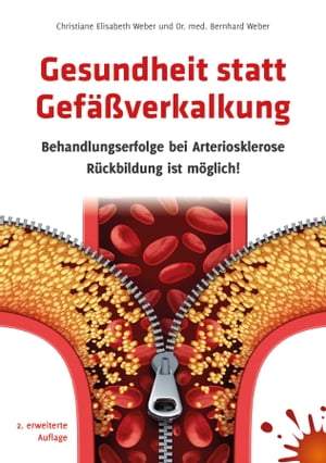 Gesundheit statt Gef??verkalkung Behandlungserfolge bei Arteriosklerose ? R?ckbildung ist m?glich! 2. erweiterte Auflage